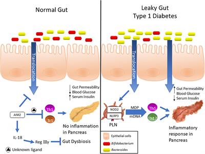 NLR and Intestinal Dysbiosis-Associated Inflammatory Illness: Drivers or Dampers?